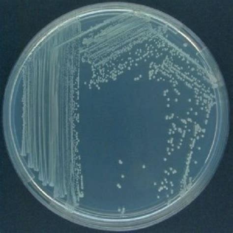 Pseudomonas Fluorescens Bacillus Fluorescens Liquefaciens स्यूडोमोनास