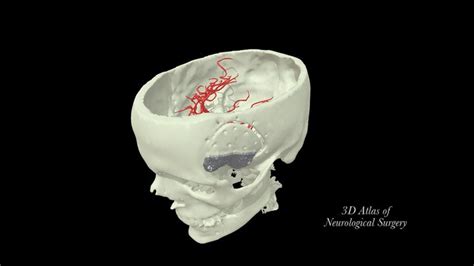 3d Atlas Of Neurological Surgery Tspiriev Sketchfab