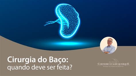 Cirurgia do Baço Quando deve ser feita Prof Dr Luiz Carneiro CRM