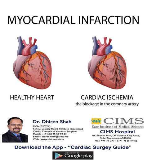 Myocardial Infraction The Best Cardiac Surgeon In Ahmedabad And Best