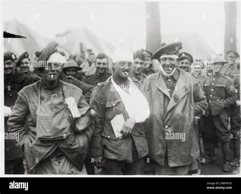 World War One Wwi Western Front Smiling Wounded Soldiers Stock