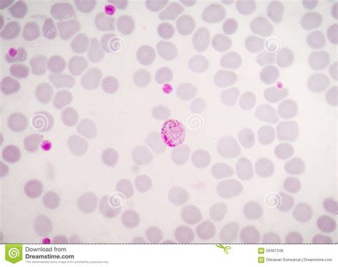 This parasite lab test includes for malaria and babesia. Blood Films For Malaria Parasite. Stock Photo - Image ...