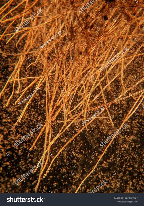 Photo Fungi Mycelia Spores Under Microscope Stock Photo 2223022927