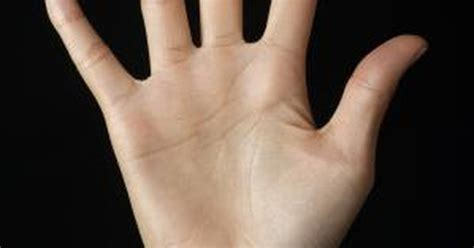 Bumps On The Palm Of A Hand Livestrongcom