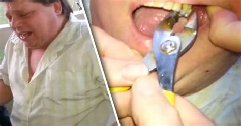 Watch Disgusting Moment Dad Saves Dosh By Getting Tooth Pulled Out