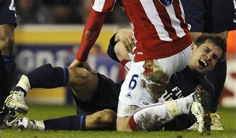 Top 5 Worst Injuries Suffered By Soccer Players With Images Worst
