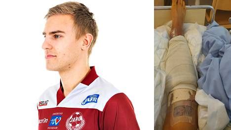 Update information for johan bruyneel ». Karmean loukkaantumisen Kajaanissa kärsinyt Johan Brunell ...