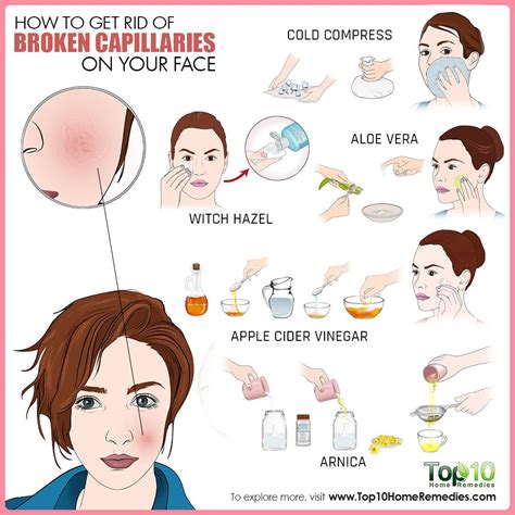 Amazing Ways To Get Rid Of Broken Capillaries On Face An Infographic