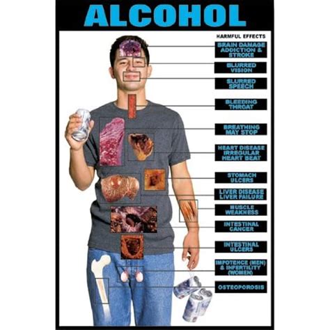 Harmful Effects Of Alcohol 24 X 36 Laminated Poster