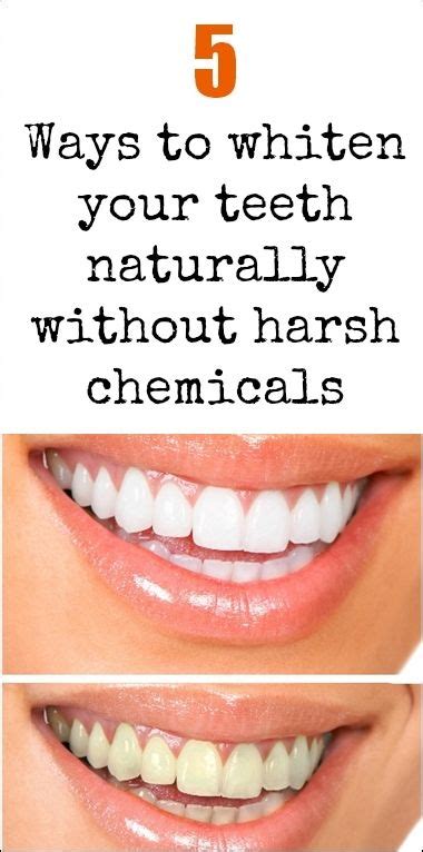 Not all dental cleanings cost the same. 5 Ways to Whiten Your Teeth Naturally Without Harsh ...