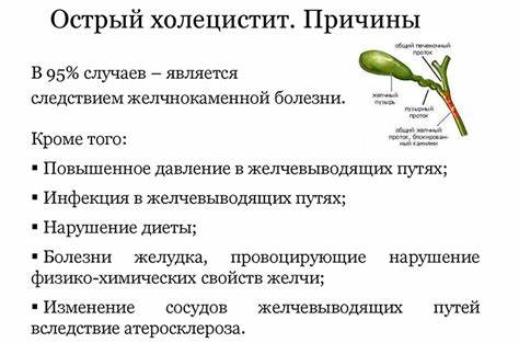 Холецистит симптомы лечение диета хронический Острый холецистит: симптомы, лечение, диета, диагностика Острый холецистит: симптомы, лечение, диета, диагностика Холецистит симптомы лечение диета хронический