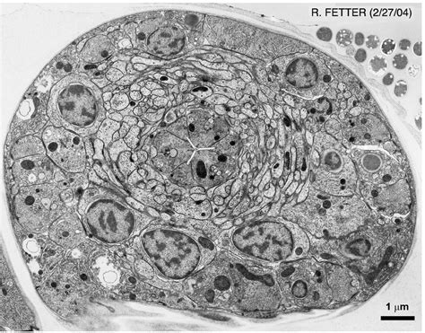 Animal Cell Electron Microscopy Nucleus Dna Store Site Maybe You