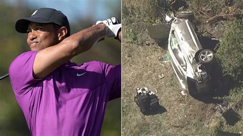 Tiger Woods Does Not Remember Crash That Left Him Hospitalized With Compound Fracture To His Leg