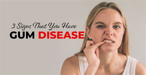 3 Signs That You Have Gum Disease Sunrise Dental
