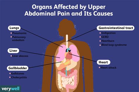 Upper Abdominal Pain Causes And When To See A Doctor