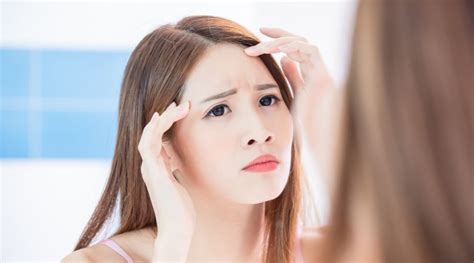 How To Get Rid Of Forehead Wrinkles Causes And Prevention Tips