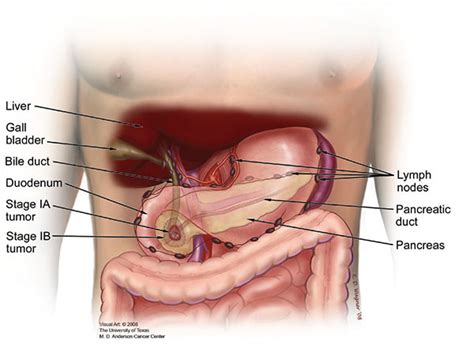 Stage 1 Throat Cancer Pictures Celine Dion Songs Age