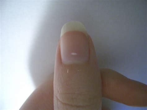 Jessica's Aesthetics: What is this white spot??