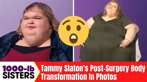 Jaw Dropping Transformation Tammy Slaton S Post Surgery Body Evolution