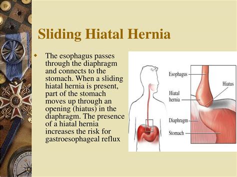 Protruding Hiatal Hernia
