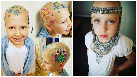 7 Year Old Girl With Alopecia Makes Her Baldness Beautiful Goes Viral