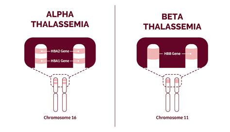 ﻿thalassemia