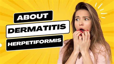 Dermatitis Herpetiformis Symptoms Causes And Diagnosing Treating