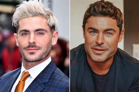 Zac Efron Plastic Surgery Video Before And After Photos In 2022 Has He Gotten Cosmetic Surgery