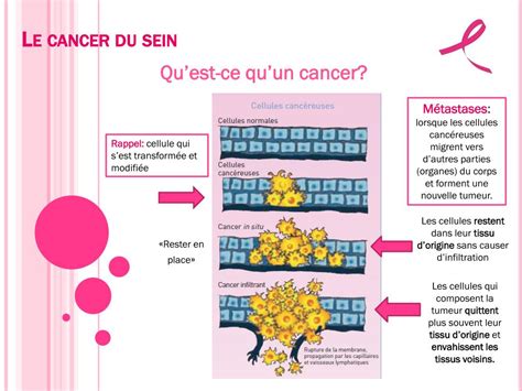 Ppt Cancer Du Sein Powerpoint Presentation Free Download Id5264739