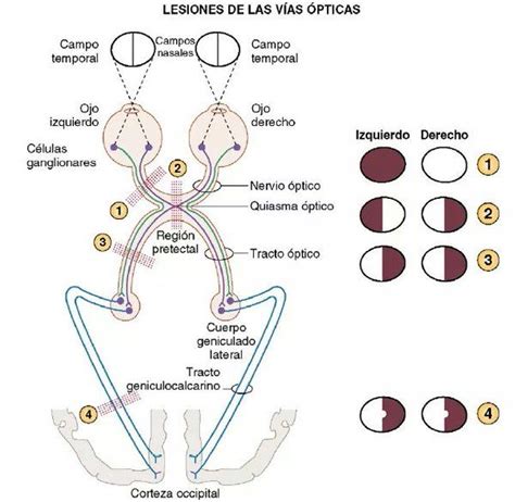 Quiasma Optico Via Optica Nervio Optico