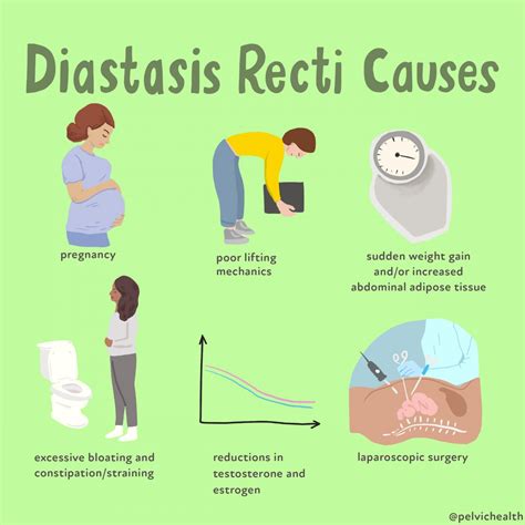 Diastasis Recti Causes And Treatment