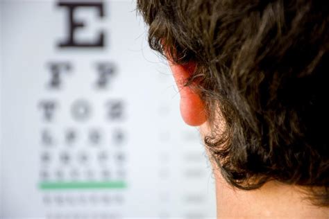 5 Signs Of Nearsightedness Benjamin Optical Eye Center