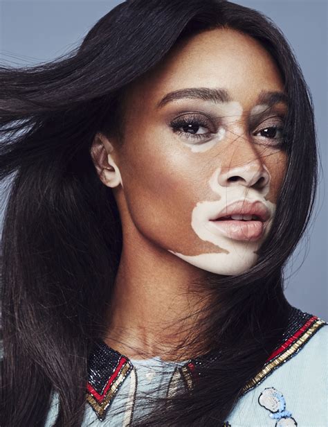 Winnie Harlow On The Cover Of Marie Claire Mexico Harry