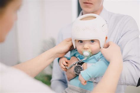 Plagiocephaly In Babies Tips To Avoid Flat Head Syndrome