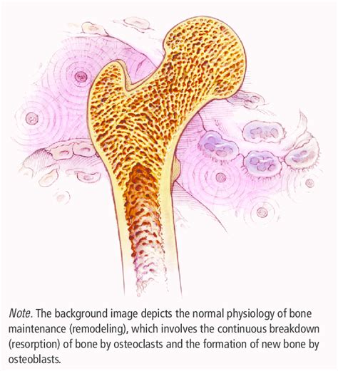 They protect your delicate internal organs and act as a storehouse for minerals, such as calcium. Osteoporosis, Showing the Thinning of Cancellous (Spongy ...