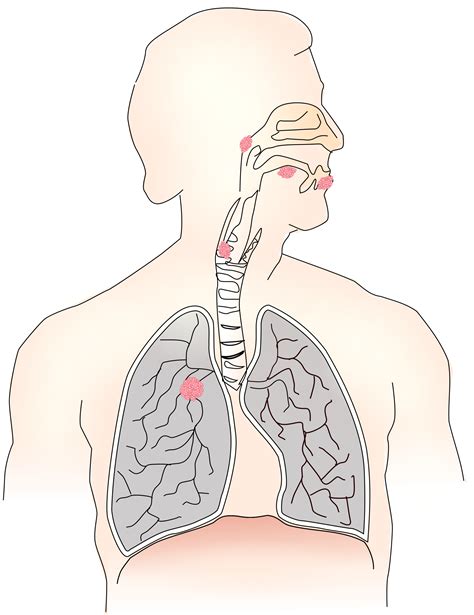 Lungs Clipart Lung Smoker Lungs Lung Smoker Transparent Free For