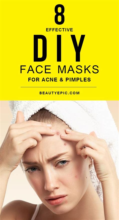 8 Effective Diy Face Masks For Acne And Pimples Acne Pimples Diy