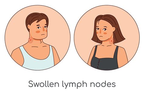 Swollen Lymph Nodes Man And Woman Icons Flu Virus Cold Cartoon Medical