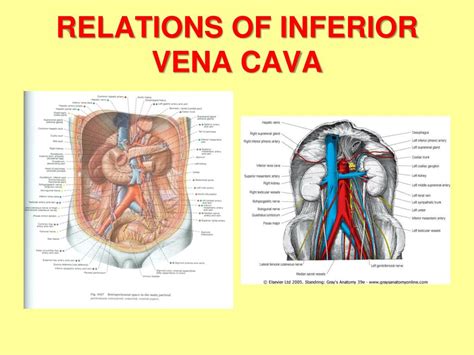 Ppt Abdominal Aorta And Inferior Vena Cava Powerpoint Presentation Id