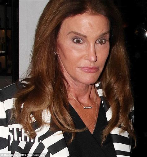Caitlyn Jenner Is Getting More Plastic Surgery To Boost Her Self