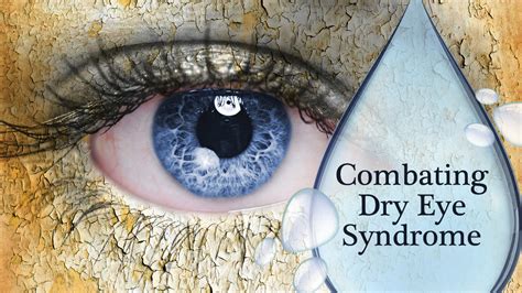 Causes Of Dry Eye Syndrome How To Combat Dry Eye Syndrome