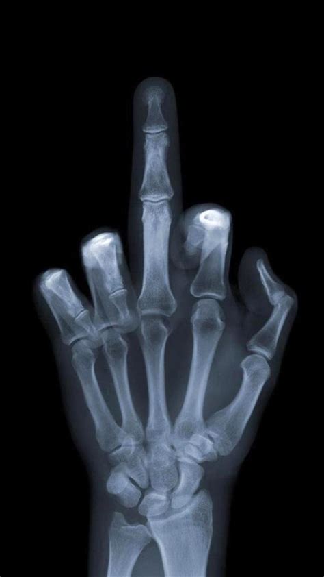 Funny X Ray Hand Sign Android Wallpaper Free Download