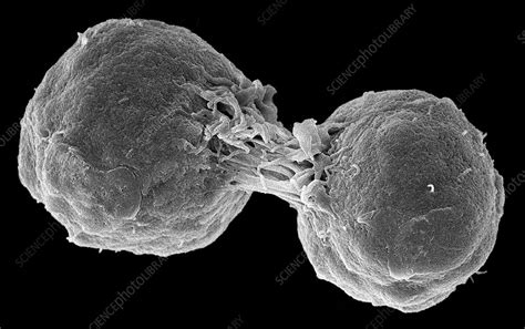 Dividing Lymphoma Cancer Cells Sem Stock Image C0372462 Science