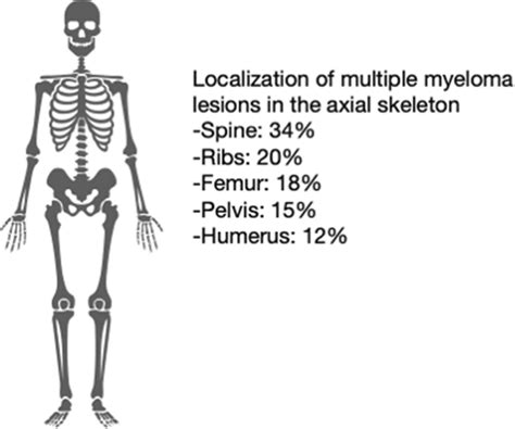 The Most Common Locations Of Multiple Myeloma Lesions Are Shown Download Scientific Diagram