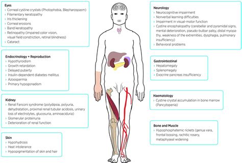 Frontiers Nephropathic Cystinosis Symptoms Treatment And