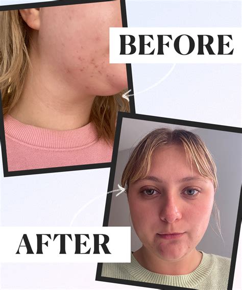 What Happened When I Tried My Moms Simple Skincare Routine The Everygirl