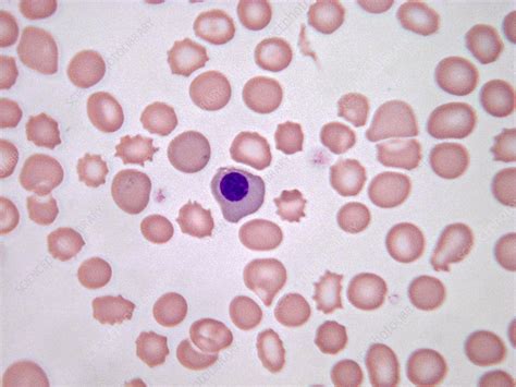 Nucleated Red Blood Cells Lm Stock Image C0435172 Science Photo