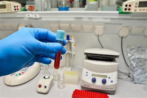 Premium Photo Laboratory Study Of Blood