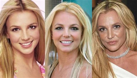Britney Spears Plastic Surgery Famousfaceshub