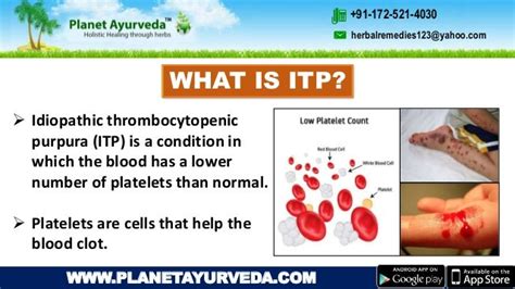 Idiopathic Thrombocytopenic Purpura Itp Treatment In Ayurveda